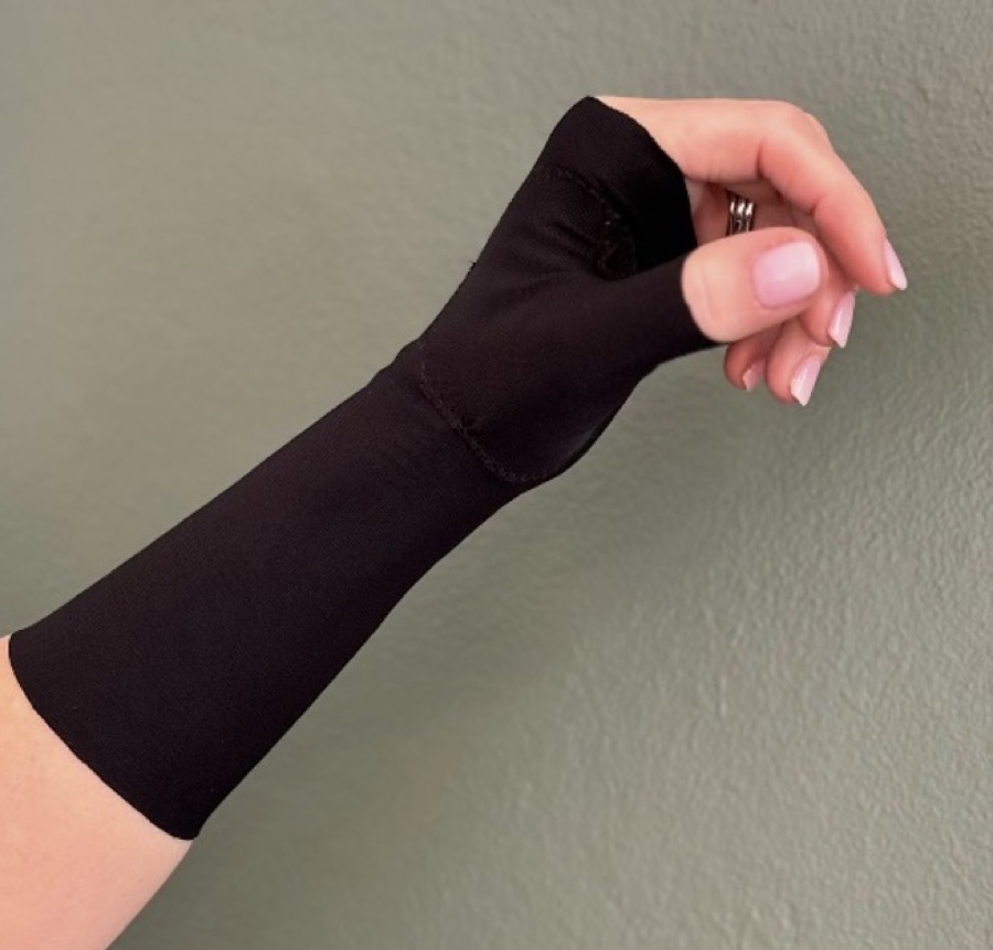 A custom-made black pressure garment worn on the hand and wrist